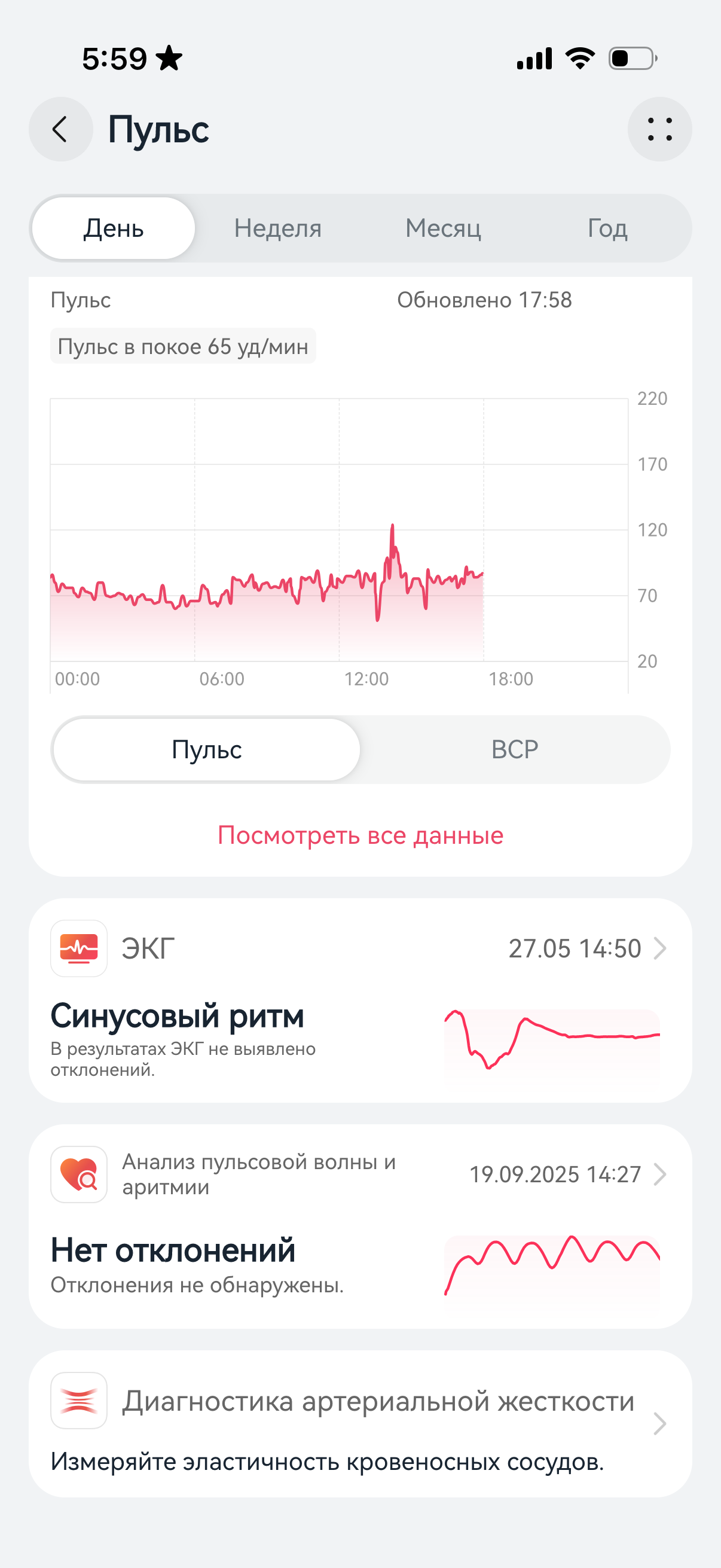 Обзор Huawei Watch Fit 5&nbsp;Pro &mdash; теперь с&nbsp;сапфировым стеклом
