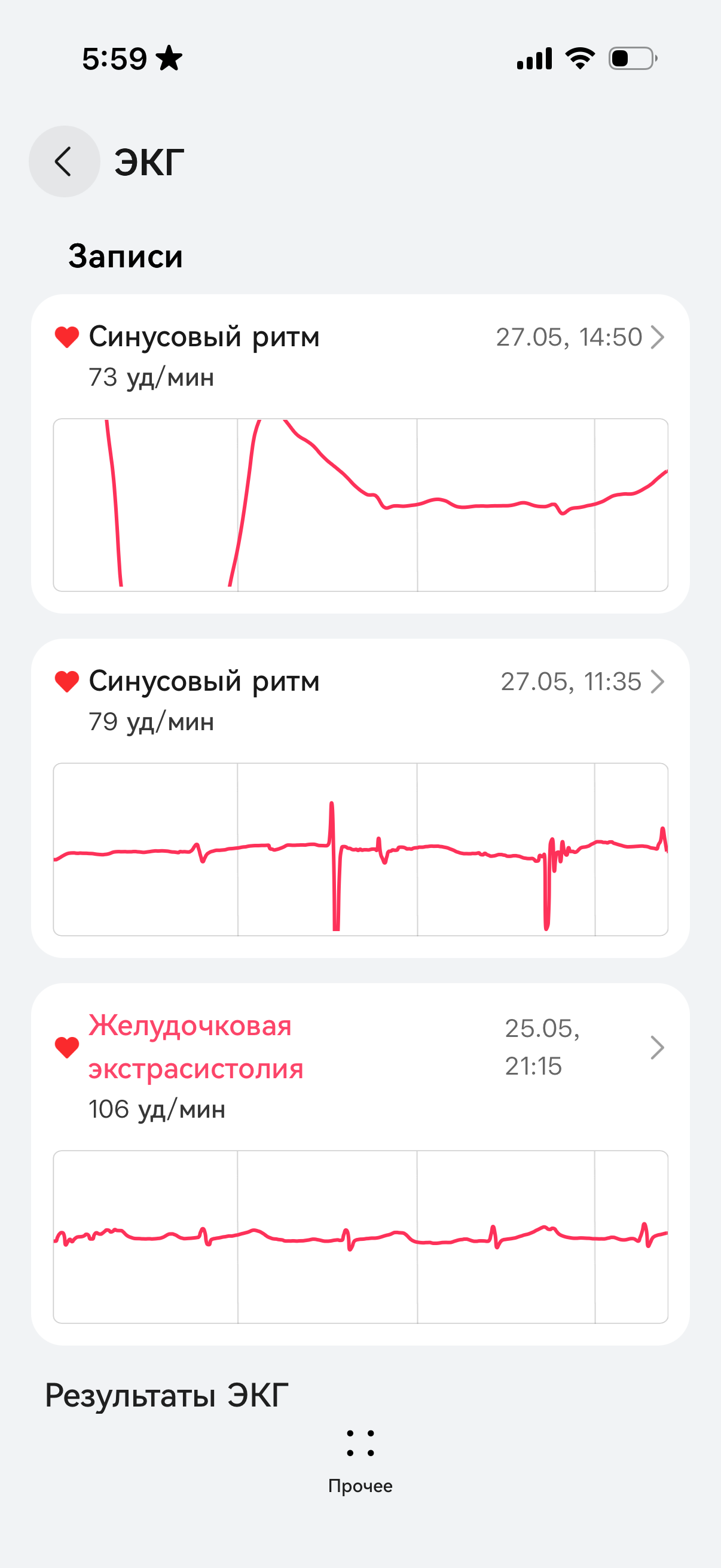 Обзор Huawei Watch Fit 5&nbsp;Pro &mdash; теперь с&nbsp;сапфировым стеклом